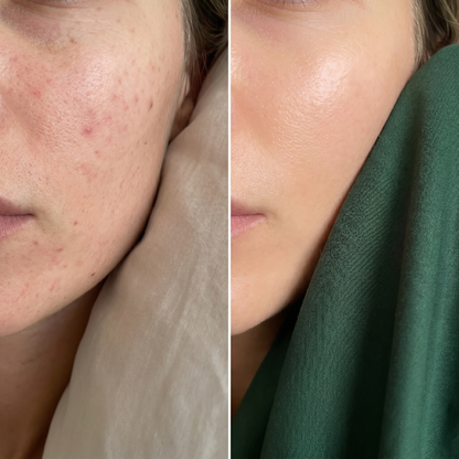 ALCURA™ Lyocell Bettwäsche